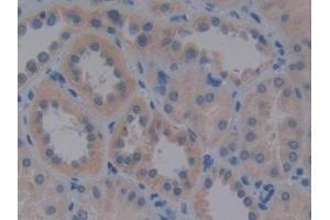 Detection of VLDLR in Human Kidney Tissue using Polyclonal Antibody to Very Low Density Lipoprotein Receptor (VLDLR) (VLDLR Antikörper  (AA 418-722))