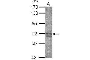 WB Image Sample (30 ug of whole cell lysate) A: NT2D1 7. (KEAP1 Antikörper  (C-Term))