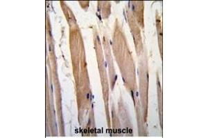 Formalin-fixed and paraffin-embedded human skeletal muscle tissue reacted with VINC antibody (N-term) , which was peroxidase-conjugated to the secondary antibody, followed by DAB staining. (Vinculin Antikörper  (N-Term))