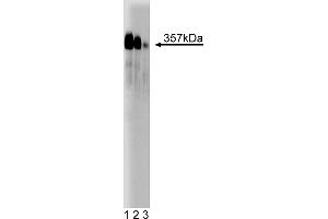 Western Blotting (WB) image for anti-Centromere Protein F (CENPF) (AA 209-381) antibody (ABIN968167) (CENPF Antikörper  (AA 209-381))