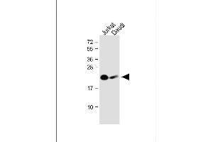 All lanes : Anti-NCR3 Antibody (N-Term) at 1:1000 dilution Lane 1: Jurkat whole cell lysate Lane 2: Daudi whole cell lysate Lysates/proteins at 20 μg per lane.