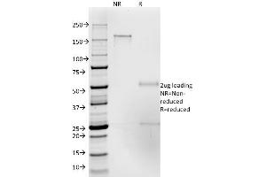 SDS-PAGE Analysis Purified CD50 Mouse Monoclonal Antibody (186-2G9).