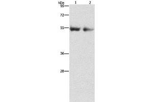 Western Blot analysis of Human right lung and left lung cancer tissue using ANGPT4 Polyclonal Antibody at dilution of 1:480 (Angiopoietin 4 Antikörper)