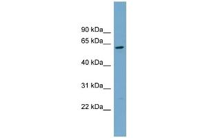WB Suggested Anti-CNDP2 Antibody Titration: 0. (CNDP2 Antikörper  (Middle Region))