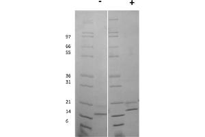 SDS-PAGE of Mouse Fibroblast Growth Factor-9 Recombinant Protein SDS-PAGE of Mouse Fibroblast Growth Factor-9 Recombinant Protein. (FGF9 Protein)