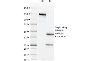 SDS-PAGE Analysis Purified CD44v6 Mouse Monoclonal Antibody (2F10). (CD44 Antikörper)