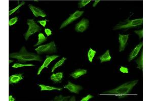 Immunofluorescence of monoclonal antibody to TUBA4A on HeLa cell. (TUBA4A Antikörper  (AA 1-448))