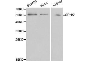 Western blot analysis of extracts of various cell lines, using SPHK1 antibody (ABIN5970017) at 1/1000 dilution. (SPHK1 Antikörper)