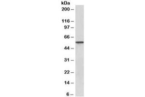 Western blot testing of human kidney lysate with Epoxide hydrolase 2 antibody at 0. (EPHX2 Antikörper)
