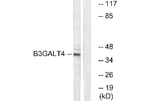 Western blot analysis of extracts from Jurkat cells, using B3GALT4 antibody. (B3GALT4 Antikörper)