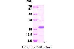 SDS-PAGE (SDS) image for Tumor Susceptibility Gene 101 (TSG101) (AA 1-145) protein (His tag) (ABIN667780)