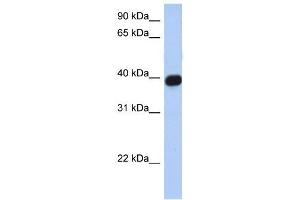 CXCR6 antibody (70R-10500) used at 0. (CXCR6 Antikörper  (N-Term))