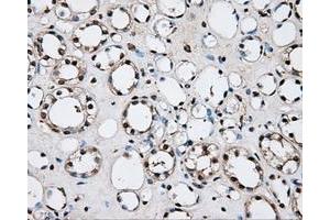 Immunohistochemical staining of paraffin-embedded liver tissue using anti-PLEKmouse monoclonal antibody. (Pleckstrin Antikörper)