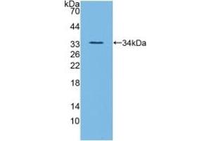 Detection of Recombinant ANGPTL3, Mouse using Polyclonal Antibody to Angiopoietin Like Protein 3 (ANGPTL3) (ANGPTL3 Antikörper  (AA 22-281))
