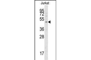 Western blot analysis of anti-G4A Pab 1808c in Jurkat cell line lysates (35 μg/lane). (ATG4A Antikörper  (AA 363-392))