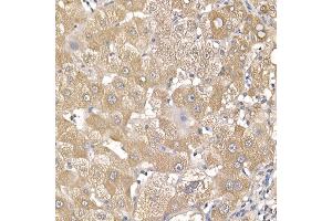 Immunohistochemistry of paraffin-embedded human liver using IL11RA Rabbit mAb (ABIN7267984) at dilution of 1:150 (40x lens). (IL11RA Antikörper)