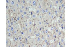 Immunohistochemistry analysis of paraffin-embedded human liver using N-cadherin Polyclonal Antibody at dilution of 1:500. (N-Cadherin Antikörper)