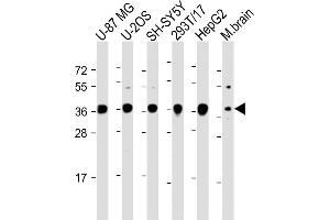 All lanes : Anti-EN1 (Engrailed 1) Antibody (N-term) at 1:2000 dilution Lane 1: U-87 MG whole cell lysate Lane 2: U-2OS whole cell lysate Lane 3: SH-SY5Y whole cell lysate Lane 4: 293T/17 whole cell lysate Lane 5: HepG2 whole cell lysate Lane 6: Mouse brain lysate Lysates/proteins at 20 μg per lane. (EN1 Antikörper  (N-Term))