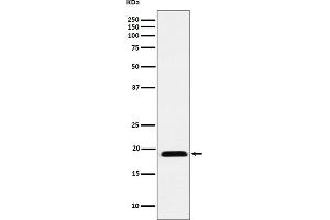 Western blot analysis of MYL12B expression in Jurkat cell lysate.