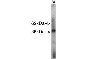 Western blot analysis using Sphingomyelin Synthase r  on recombinant protein Lane A] antibody alone. (SAMD8 Antikörper)