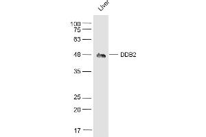 Mouse Liver lysates probed with DDB2 Polyclonal Antibody, Unconjugated  at 1:500 dilution and 4˚C overnight incubation. (DDB2 Antikörper  (AA 201-300))