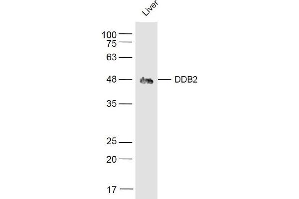DDB2 Antikörper  (AA 201-300)