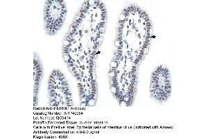 ARP40384 Paraffin Embedded Tissue: Human Intestine Cellular Data: Epithelial cells of intestinal villas Antibody Concentration: 4. (HNRNPA1 Antikörper  (C-Term))