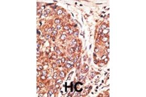 Immunohistochemistry (Paraffin-embedded Sections) (IHC (p)) image for anti-Septin 9 (SEPT9) (AA 57-85), (C-Term) antibody (ABIN390155)