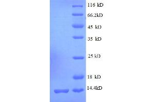 30S Ribosomal Protein S19 (AA 2-92), (full length) protein (His tag)