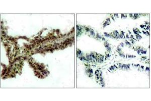 Image no. 1 for anti-V-Akt Murine Thymoma Viral Oncogene Homolog 1 (AKT1) (pThr308) antibody (ABIN196710) (AKT1 Antikörper  (pThr308))