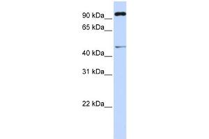 WB Suggested Anti-TRIM15 Antibody Titration: 0. (TRIM15 Antikörper  (Middle Region))