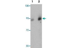 Western blot analysis of human brain tissue with DCLK1 polyclonal antibody  at (Lane 1) 0. (DCLK1 Antikörper  (N-Term))