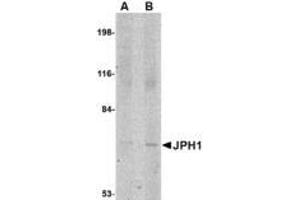 Image no. 1 for anti-Junctophilin 1 (JPH1) (C-Term) antibody (ABIN341697) (Junctophilin 1 Antikörper  (C-Term))