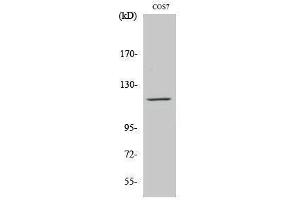 Western Blotting (WB) image for anti-PTK2B Protein tyrosine Kinase 2 beta (PTK2B) (Ser373) antibody (ABIN3186607)