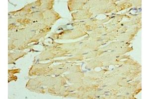 Immunohistochemistry of paraffin-embedded human skeletal muscle tissue using ABIN7162696 at dilution of 1:100 (PNPLA2 Antikörper  (AA 265-504))