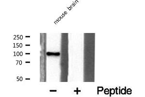 Western blot analysis of extracts from mouse brain cells, using GCN5L2 antibody. (KAT2A Antikörper  (C-Term))