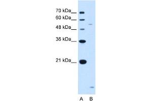 WB Suggested Anti-ST3GAL5 Antibody Titration:  1. (ST3GAL5 Antikörper  (N-Term))
