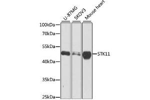 Western Blotting (WB) image for anti-serine/threonine Kinase 11 (STK11) (AA 134-433) antibody (ABIN3022973)