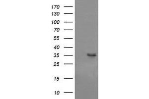 Western Blotting (WB) image for anti-T-cell surface glycoprotein CD1c (CD1C) antibody (ABIN2670669) (CD1c Antikörper)