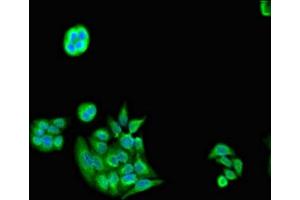 Immunofluorescent analysis of PC-3 cells using ABIN7142238 at dilution of 1:100 and Alexa Fluor 488-congugated AffiniPure Goat Anti-Rabbit IgG(H+L) (PSMC5 Antikörper  (Regulatory Subunit 8))