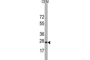 Western blot analysis of BarX1 Antibody (C-term) in CEM cell line lysates (35 µg/lane). (BARX1 Antikörper  (C-Term))