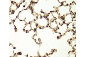 Immunohistochemistry of paraffin-embedded Mouse lung using ERCC3 Polyclonal Antibody at dilution of 1:200 (40x lens). (ERCC3 Antikörper)