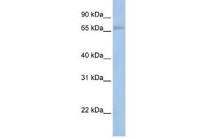 MAP3K2 antibody used at 1 ug/ml to detect target protein. (MAP3K2 Antikörper  (N-Term))