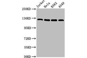 Western Blot Positive WB detected in: Jurkat whole cell lysate, Hela whole cell lysate, K562 whole cell lysate, A549 whole cell lysate All lanes: POLD1 antibody at 5 μg/mL Secondary Goat polyclonal to rabbit IgG at 1/50000 dilution Predicted band size: 124 kDa Observed band size: 124 kDa (POLD1 Antikörper  (Catalytic Subunit))