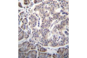 Immunohistochemistry (IHC) image for anti-Secreted Frizzled-Related Protein 5 (SFRP5) antibody (ABIN2997051)