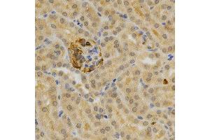 Immunohistochemistry of paraffin-embedded mouse kidney using TNFRSF11B antibody at dilution of 1:200 (x400 lens) (Osteoprotegerin Antikörper)