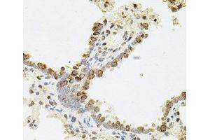 Immunohistochemistry of paraffin-embedded Rat lung using REG3A Polyclonal Antibody (REG3A Antikörper)