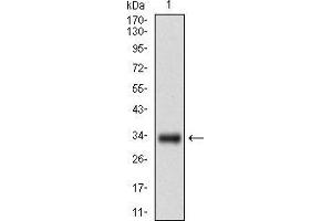 Western blot analysis using GSC mAb against human GSC recombinant protein. (GSC Antikörper  (AA 191-257))