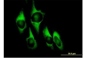 Immunofluorescence of purified MaxPab antibody to EEF1D on HeLa cell. (EEF1D Antikörper  (AA 1-281))