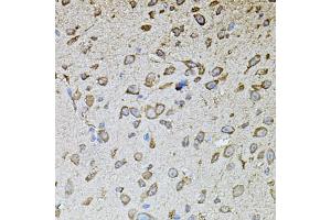 Immunohistochemistry of paraffin-embedded mouse brain using MPO antibody (ABIN4904410) at dilution of 1:100 (40x lens). (Myeloperoxidase Antikörper)